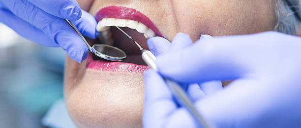 Best Emergency Dental Services for Seniors in Glasco, NY